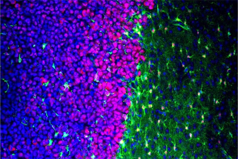 gliomas alter astrocytes