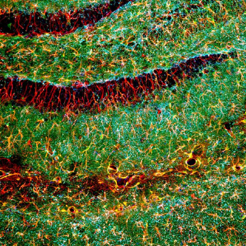Hippocampus Stained Image