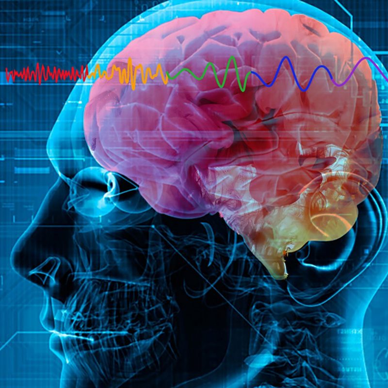 neuroimagen research area