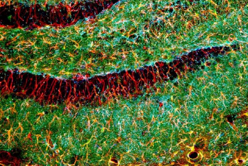 Hippocampus_rbGFAP